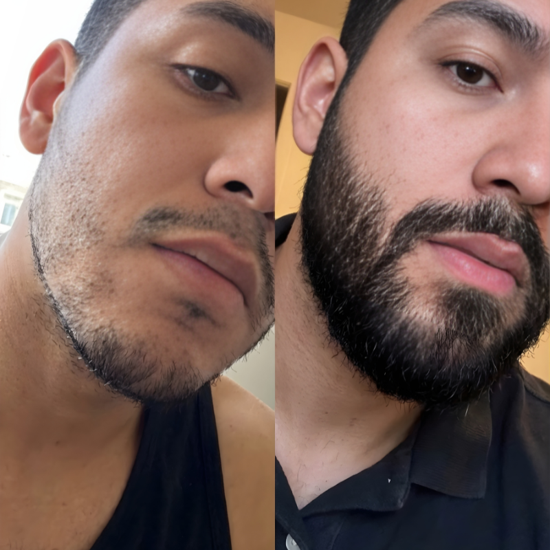 Estimulante De Barba Apolo